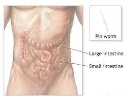 Thread worms in gut